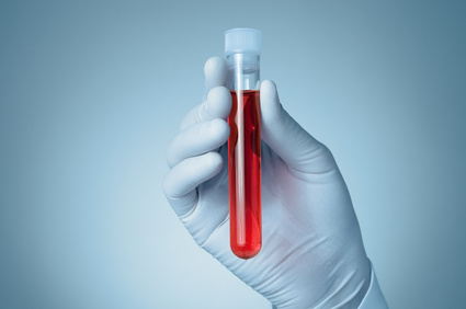 Esami di laboratorio ematochimici: a cosa servono?